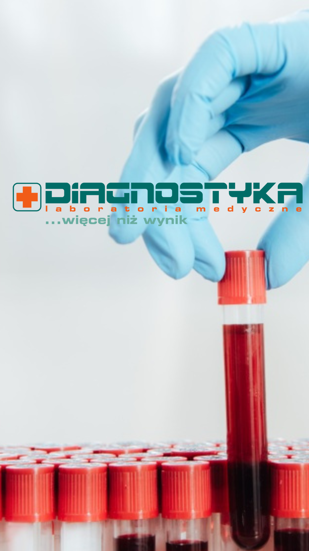 Diagnostyka, punkt pobrań labolatoryjnych